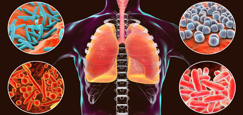 TUBERCLOSIS & RESPIRATORY
